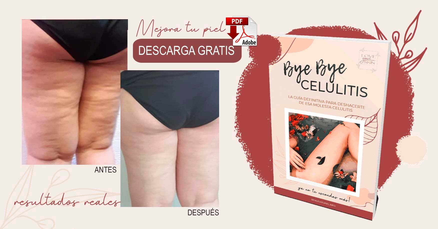 como eliminar la celulitis de piernas, glúteos y brazos