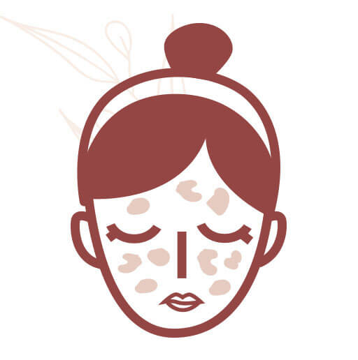 piel con manchas y paño del rostro del embarazo renueva tu piel love your skin